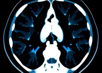 AI-Powered CT Scan Analysis Promises to Accelerate Clinical Assessments