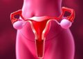 Antifibrotic Drug Offers New Hope for Treating Premature Ovarian Insufficiency