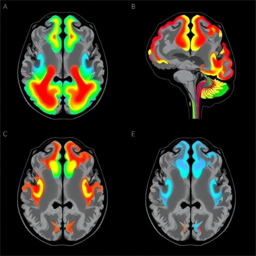 BrainParc: Unified Lifespan Brain Maps from MRI - BIOENGINEER.ORG