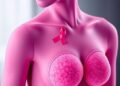 Breast Cancer Resistance Fueled by Genetic Deficiencies