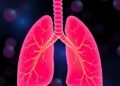 Cobalamin C Deficiency Linked to Pediatric Pulmonary Hypertension