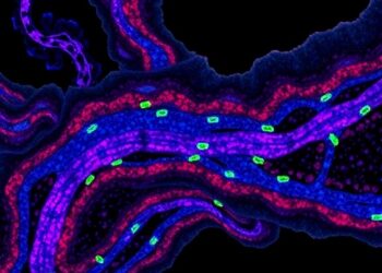 Deep Learning-Powered Virtual Multiplex Immunostaining of Label-Free Tissues Advances Vascular Invasion Assessment
