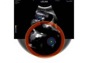 FDA Grants De Novo Clearance to Ultrasound AI for Delivery Date Prediction Technology