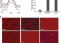Hsp47 in Fat Tissue Drives Diet-Induced Inflammation