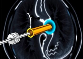 MRI-Steered Concentric Tube Catheter Enables Precise Interventions