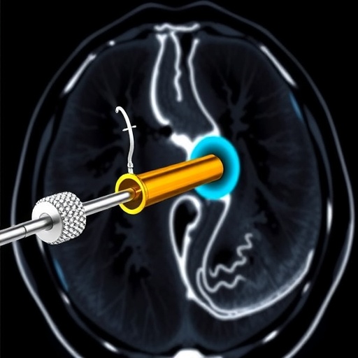 MRI-Steered Concentric Tube Catheter Enables Precise Interventions