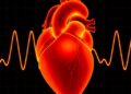 Modeling Heart Rate to Quantify Neonatal Opioid Withdrawal