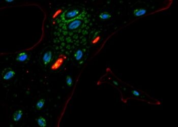 TCF4 Repeat Expansion Alters Fuchs Corneal Proteome