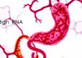tRNA-Derived Small RNAs Linked to Necrotizing Enterocolitis