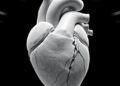 3D Heart Study in Congenital Diaphragmatic Hernia