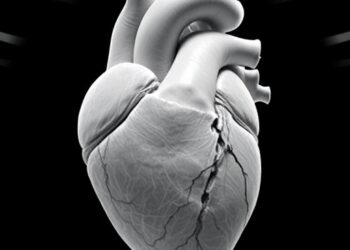 3D Heart Study in Congenital Diaphragmatic Hernia
