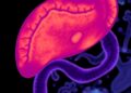AI Model Identifies Early, Typically Invisible Tissue Changes Indicative of Pancreatic Cancer — Technology and Engineering