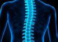 Aging Biomarkers Linked to Spinal Disc Degeneration