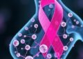 Decoding the Hidden Clues of Breast Cancer Risk