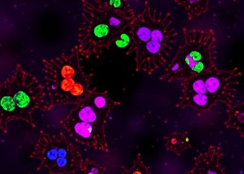Exosomal miR-122-3p Emerges as Crucial Driver in Metabolic Dysfunction-Associated Steatotic Liver Disease