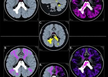 HKUST Unveils Innovative AI Pathology System for Precise Multi-Cancer Diagnosis Without Extra Model Training