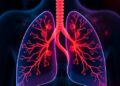 Halt the Inflammatory Cascade: Xuebijing’s Role in Safeguarding the Lung Barrier During Acute Lung Injury