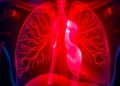 Intermittent Hypoxemia Improves BPD Severity Prediction — Technology and Engineering