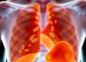 Lipid Build-Up Blocks Immune Response in Tuberculosis