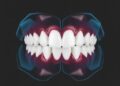 Machine Learning Predicts Class III Malocclusion Treatment