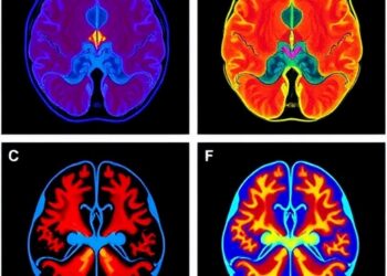 Neuromorphic Event-Based Camera Achieves Kilohertz Vascular Imaging and Functional Brain Reconstruction in Living Subjects
