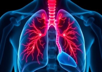 New Insights into Acute Respiratory Distress Syndrome (ARDS) in Critically Ill Cirrhosis Patients