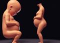 New Model Reveals Why Single Births Predominate in Human Pregnancies