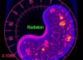 New Scoring Tool Reveals How Radiation Reprograms the Pancreatic Tumor Microenvironment