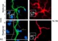 New Study Reveals Critical Mechanism Behind Motor Neuron Degeneration in ALS — Biology
