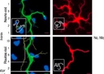 New Study Reveals Critical Mechanism Behind Motor Neuron Degeneration in ALS — Biology