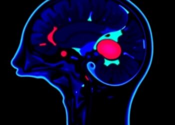 Nigeria Launches National Cancer Imaging Repository Framework