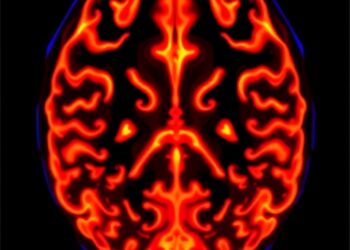 Novel Biomarker Enhances Assessment of Glioblastoma Aggressiveness