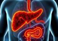 Prebiotic Xylooligosaccharides Improve Liver Disease via Gut