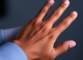 REACH Trial Demonstrates High Accuracy of Smart Finger Cuff Algorithm in Detecting Moderate-to-Severe Cases Among African American Patients
