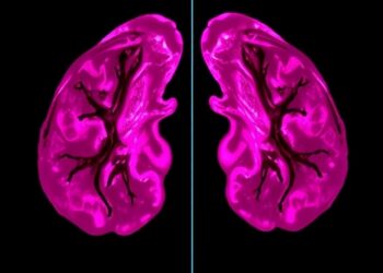 Reciprocal Fusion of SqueezeNet, ShuffleNetV2 Detects Breast Cancer