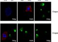 SCFFBXO42 Controls PP2A Degradation Pathway