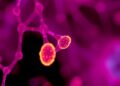 Advanced Models Pave the Way for Improved Therapies Targeting Primary Sclerosing Cholangitis — Biology