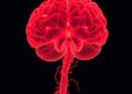 Advancing Cognitive Profiling: Deep Learning Revolutionizes Classification of Subcortical Vascular Cognitive Impairment — Medicine