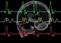 Continuous EEG Reveals Seizures After Neonatal Heart Surgery — Technology and Engineering