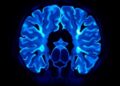 Enhancing Low-Dose CT Scans with Interpretable Multi-Gaussian Cluster Variance Reduction — Technology and Engineering