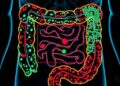 Gut Microbiome Clusters Offer New Insights into Predicting Inflammatory Bowel Disease Severity and Progression — Biology