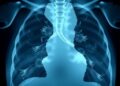 Hypoxic Burden Links to Bronchopulmonary Dysplasia Risk — Technology and Engineering