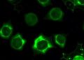 Indocyanine Green Fluorescence Differentiates Neuroblastic Tumors — Technology and Engineering