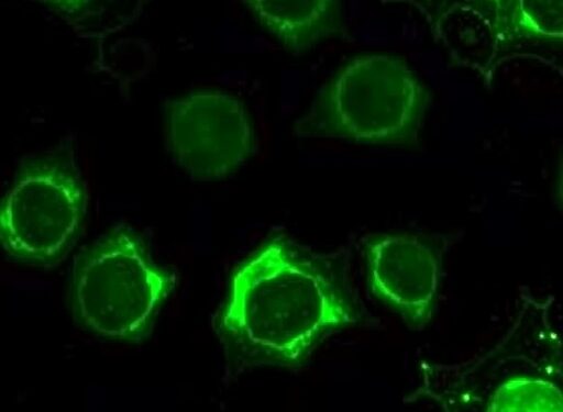 Indocyanine Green Fluorescence Differentiates Neuroblastic Tumors — Technology and Engineering