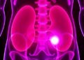 MIT Researchers Create Innovative Sensor for Earlier Bladder Cancer Detection — Technology and Engineering
