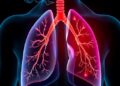 New Insights into How Smoking Causes Lung Stiffness — Biology