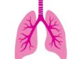 New Study Links Advanced Lung Cancer Inflammation Index to Stroke Recovery Post-Thrombolysis — Biology