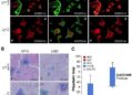 New Study Uncovers Role of GADD45B in Intestinal Ischemia/Reperfusion Injury — Biology