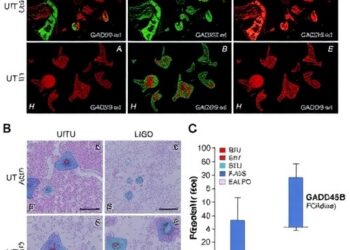 New Study Uncovers Role of GADD45B in Intestinal Ischemia/Reperfusion Injury — Biology