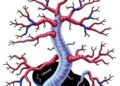 Noncanonical Sulfur Metabolism, Immunity Altered in Down Syndrome — Technology and Engineering